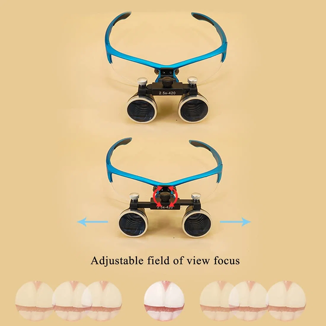 Loupes binoculaires chirurgicales antibuée pour Dentiste 2,5X 3,5X 420 mm Eclairante Lunette grossissante High Intensity LED lightdi, Loupes Jumelles Chirurgicales en Verre Optique